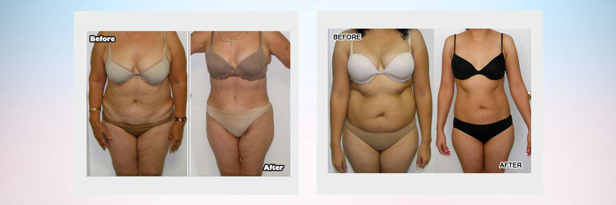 Sculptor Body - Health & Beauty