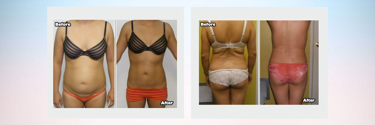Sculptor Body - Health & Beauty