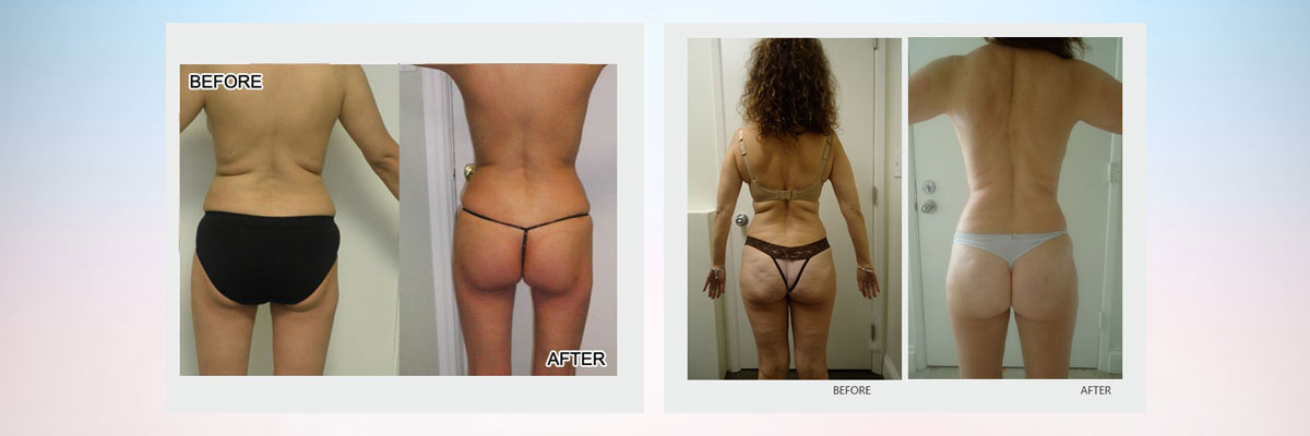 Sculptor Body - Health & Beauty