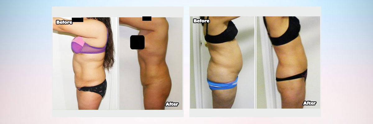 Sculptor Body - Health & Beauty