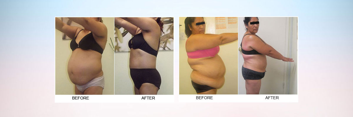 Sculptor Body - Health & Beauty
