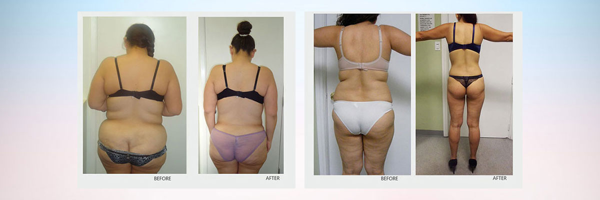 Sculptor Body - Health & Beauty