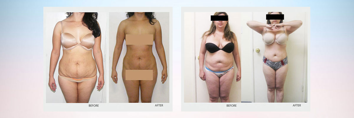 Sculptor Body - Health & Beauty