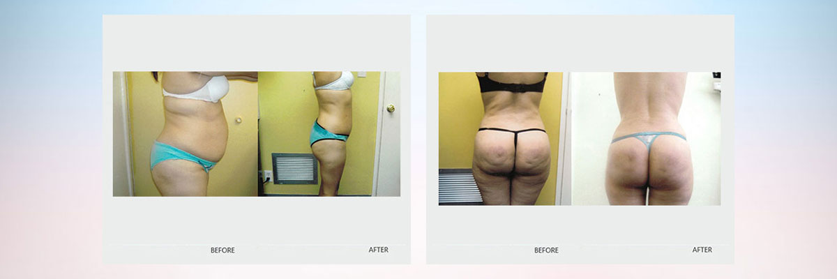 Sculptor Body - Health & Beauty
